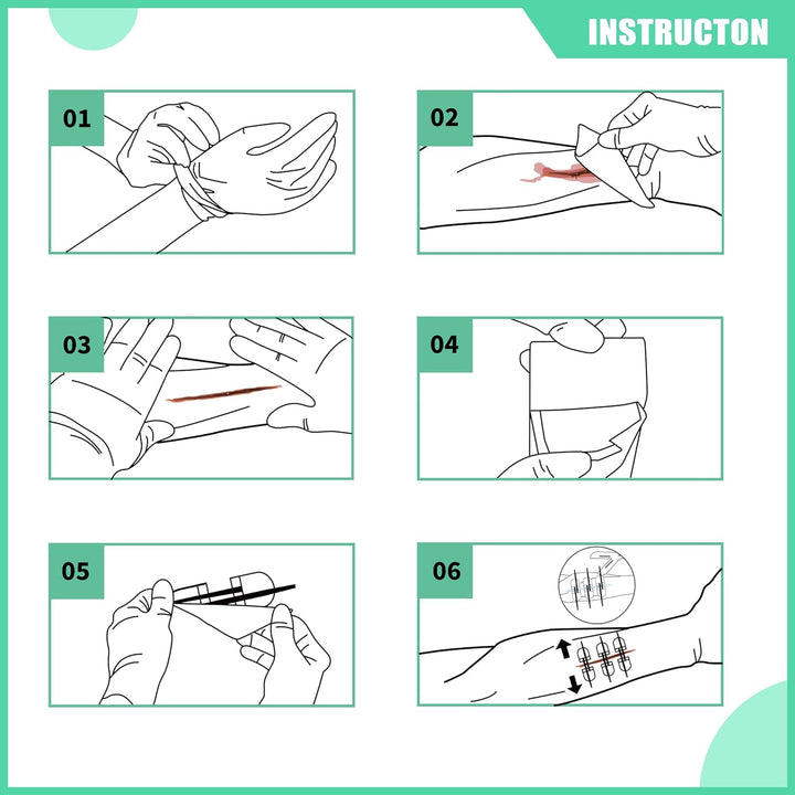 Kit de cierre de heridas avanzado™ X2