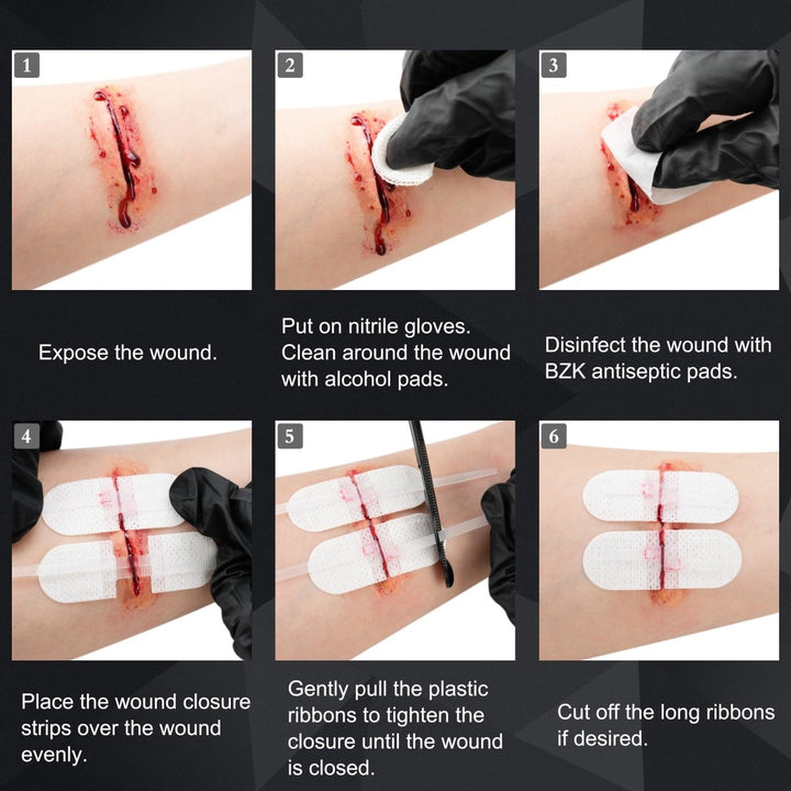 Kit de cierre de heridas avanzado™ X2